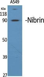 Western blot analysis of various cells using Anti-NBN Antibody