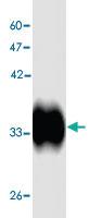 Anti-Hepatitis A virus 2C Mouse Monoclonal Antibody [clone: 1s35d]