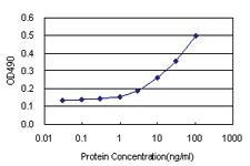 Anti-TCL1A Antibody Pair