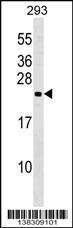 Anti-N6AMT1 Rabbit Polyclonal Antibody (HRP (Horseradish Peroxidase))