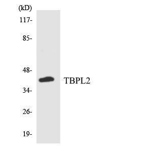 Antibody anti-TBPL2 A99596-100 100 µg