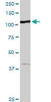 Anti-MTHFD1 Rabbit Polyclonal Antibody