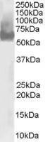 Anti-WAS Antibody (A83705) staining (0.03µg/ml) of U937 lysate (RIPA buffer, 30µg total protein per lane). Primary incubated for 1 hour. Detected by western blot using chemiluminescence.