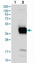 Anti-FNDC8 Rabbit Polyclonal Antibody