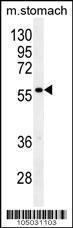 Anti-GPC3 Rabbit Polyclonal Antibody