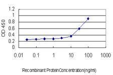 Anti-ADAM17 Mouse Monoclonal Antibody [clone: 1F6]