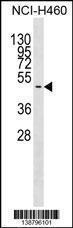 Anti-GNAS Rabbit Polyclonal Antibody (HRP (Horseradish Peroxidase))