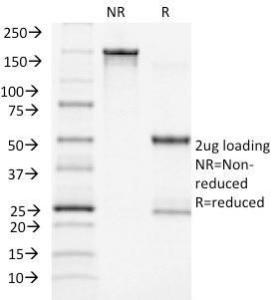 SDS-PAGE analysis of Anti-ACTH Antibody [CLIP/1418] under non-reduced and reduced conditions; showing intact IgG and intact heavy and light chains, respectively. SDS-PAGE analysis confirms the integrity and purity of the antibody.