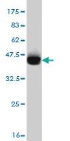 Anti-ABCC4 Mouse Monoclonal Antibody [clone: 1B2]