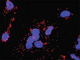 Anti-PRKCB + CHUK Antibody Pair