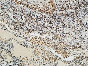 Immunohistochemical analysis of paraffin-embedded human lung using Anti-NBN Antibody