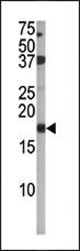 Anti-CDKN2A Rabbit Polyclonal Antibody