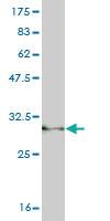 Anti-PLA2G1B Mouse Monoclonal Antibody [clone: 1B3]