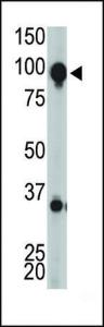 Anti-GRM8 Rabbit Polyclonal Antibody (APC (Allophycocyanin))