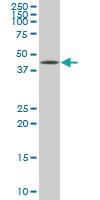 Anti-XBP1 Mouse Monoclonal Antibody [clone: 3F5]