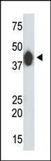 Anti-CKMT2 Rabbit Polyclonal Antibody (HRP (Horseradish Peroxidase))