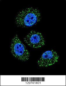 Anti-MYBPHL Rabbit Polyclonal Antibody (HRP (Horseradish Peroxidase))