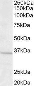 Anti-GNB3 antibody