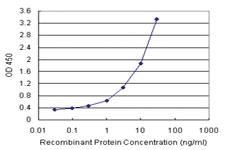 Anti-ERCC6L Polyclonal Antibody Pair