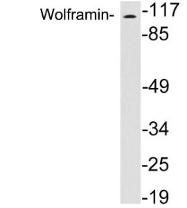 Western blot analysis of lysates from brain tissue using Anti-Wolframin Antibody