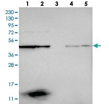 Anti-CCBL2 Rabbit Polyclonal Antibody