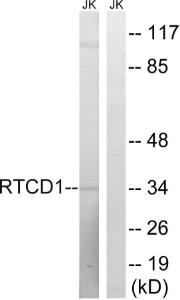 Western blot analysis of lysates from Jurkat cells using Anti-RTCD1 Antibody. The right hand lane represents a negative control, where the antibody is blocked by the immunising peptide