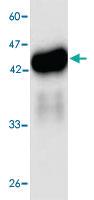 Anti-Listeria monocytogenes Hly Mouse Monoclonal Antibody [clone: 68s45]