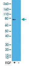 Anti-RPS6KA1 Rabbit Monoclonal Antibody [clone: RM233]