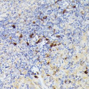 Anti-Cathepsin G Rabbit Polyclonal Antibody