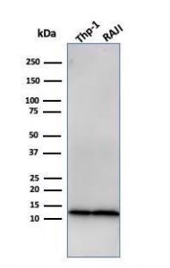 Western blot analysis of THP-1 and Raji Cell lysates using Anti-beta 2 Microglobulin Antibody [rB2M/961]