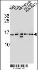 Anti-HIST1H2AB Rabbit Polyclonal Antibody (AP (Alkaline Phosphatase))