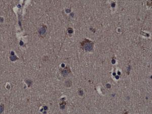 Anti-RPS6KA1 Rabbit Monoclonal Antibody [clone: RM233]