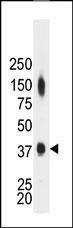 Anti-CKM Rabbit Polyclonal Antibody (Biotin)