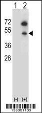 Anti-GNAS Rabbit Polyclonal Antibody (PE (Phycoerythrin))