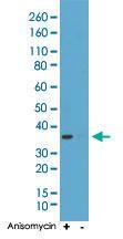 Anti-MAPK14 Rabbit Monoclonal Antibody [clone: RM243]