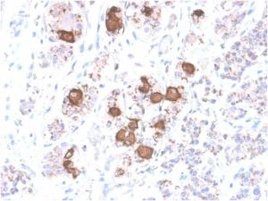 Immunohistochemical analysis of formalin-fixed, paraffin-embedded human pituitary using Anti-ACTH Antibody [CLIP/2040R]