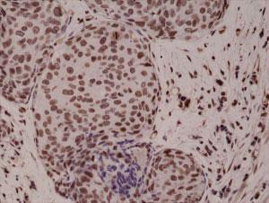 Anti-MAPK14 Rabbit Monoclonal Antibody [clone: RM243]