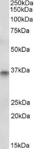 Anti-CDX2 Antibody (A83711) (1 µg/ml) staining of Human Colon lysate (35 µg protein in RIPA buffer). Detected by chemiluminescence