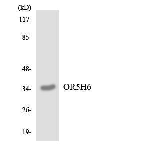 Western blot analysis of the lysates from COLO205 cells using Anti-OR5H6 Antibody