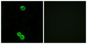 Immunofluorescence analysis of MCF7 cells using Anti-RPL3L Antibody. The right hand panel represents a negative control, where the antibody was pre-incubated with the immunising peptide.