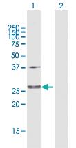 Anti-GLUD2 Rabbit Polyclonal Antibody