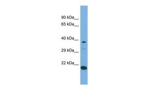 Anti-LIPT2 Rabbit Polyclonal Antibody