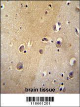 Anti-MYLIP Rabbit Polyclonal Antibody (HRP (Horseradish Peroxidase))