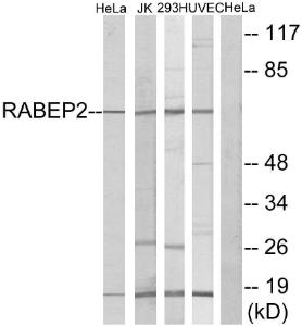 Anti-RABEP2 Rabbit Polyclonal Antibody