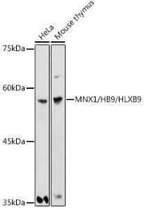 Western blot analysis of extracts of various cell lines, using Anti-HB9 / HLXB9 / MNX1 Antibody (A306300) at 1:1000 dilution