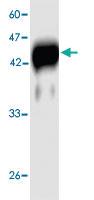 Anti-Listeria monocytogenes Hly Mouse Monoclonal Antibody [clone: 2v1d]