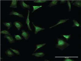 Anti-XBP1 Mouse Monoclonal Antibody [clone: 3F5]