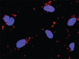 Anti-STK36 + GLI1 Antibody Pair