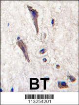 Anti-SPRED1 Rabbit Polyclonal Antibody