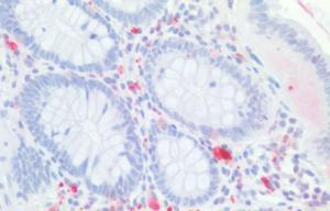 Anti-CDX2 Antibody (A83711) (5 µg/ml) staining of paraffin embedded Human Colon. Steamed antigen retrieval with citrate buffer pH 6, AP-staining